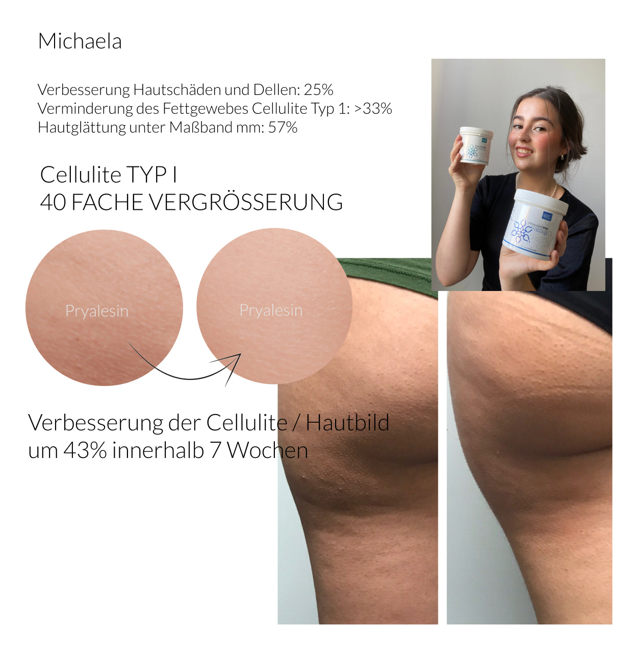 Pryalesin Tag und Nacht Creme Set 2x250ml (XXL Tiegel)