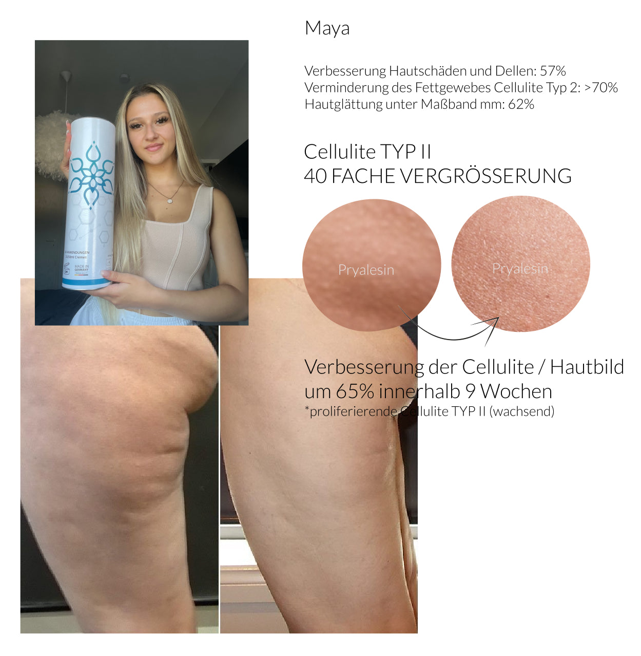 Pryalesin Tag und Nacht Creme Set 2x250ml (XXL Tiegel)